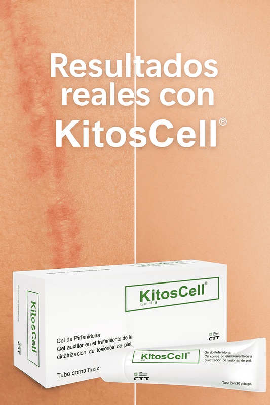 Cicatrices que no desaparecen, ¡tienen solución!